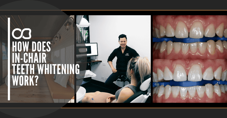 Gold_Coast_Dentist_In-Chair Teeth Whitening