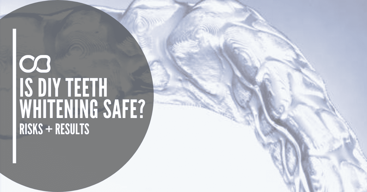 teeth-whitening-bleaching-tray