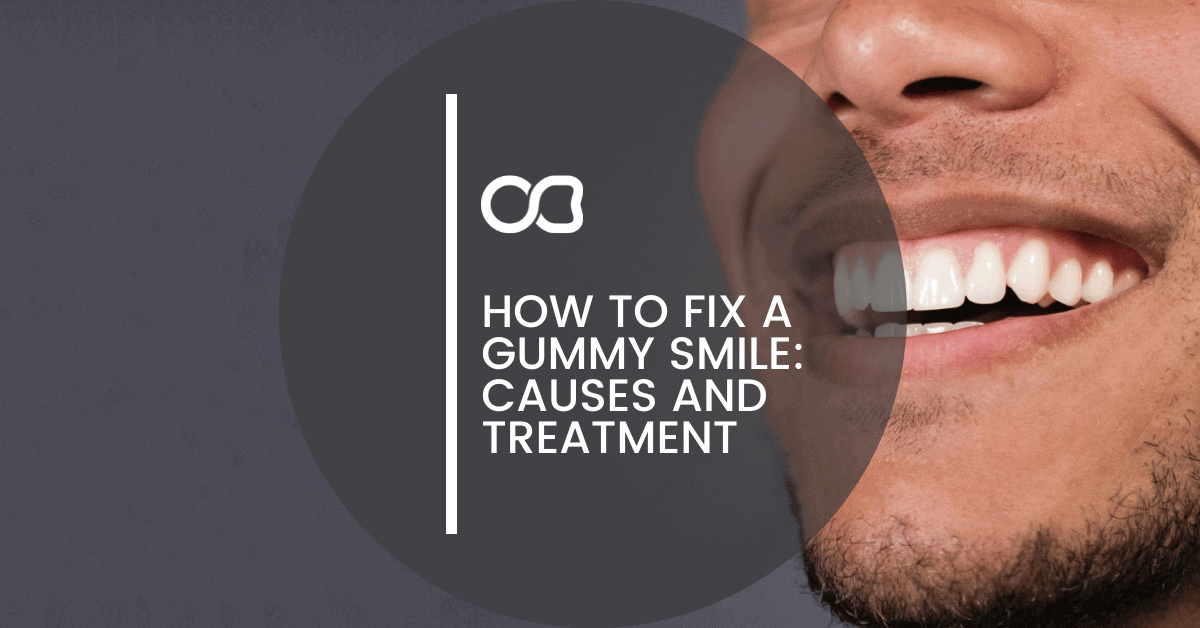 How to Fix a Gummy Smile: Causes and Treatment - 45