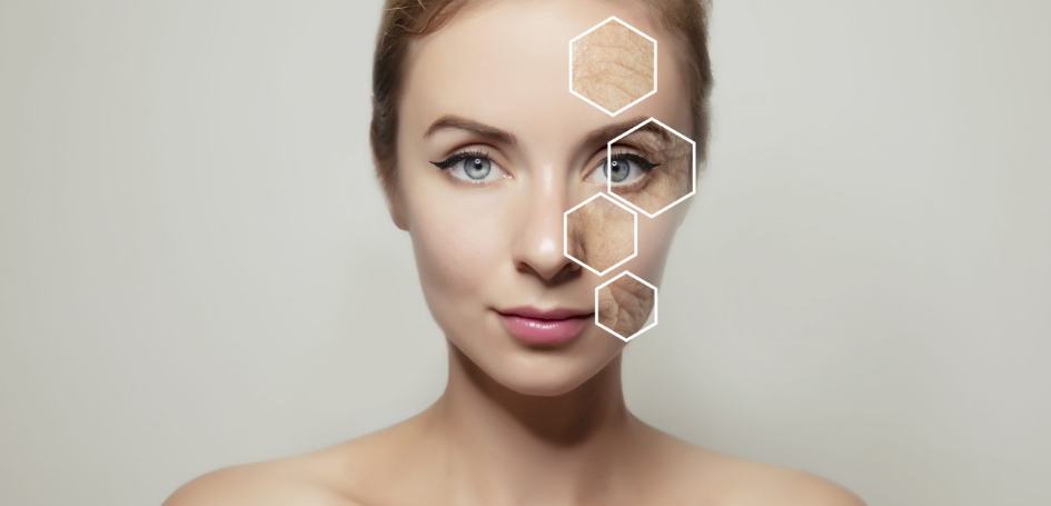 anti-wrinkle-injections