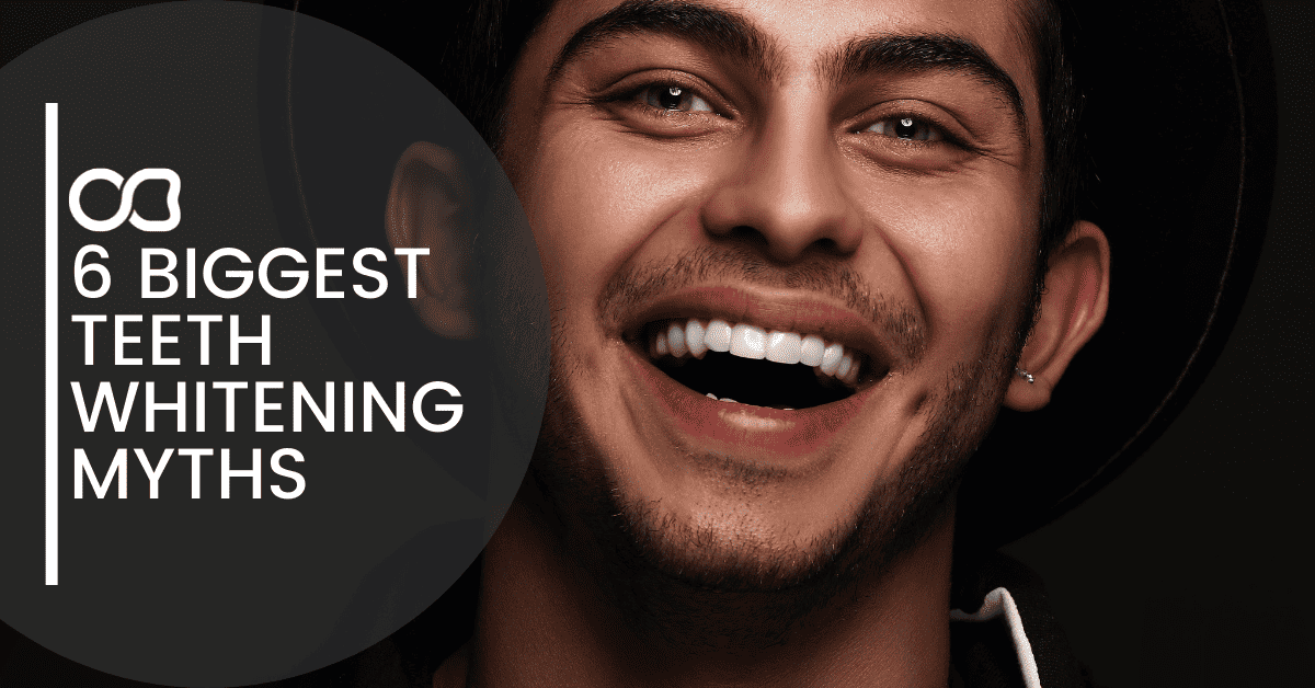 man-smiling-gold-coast-teeth-whitening