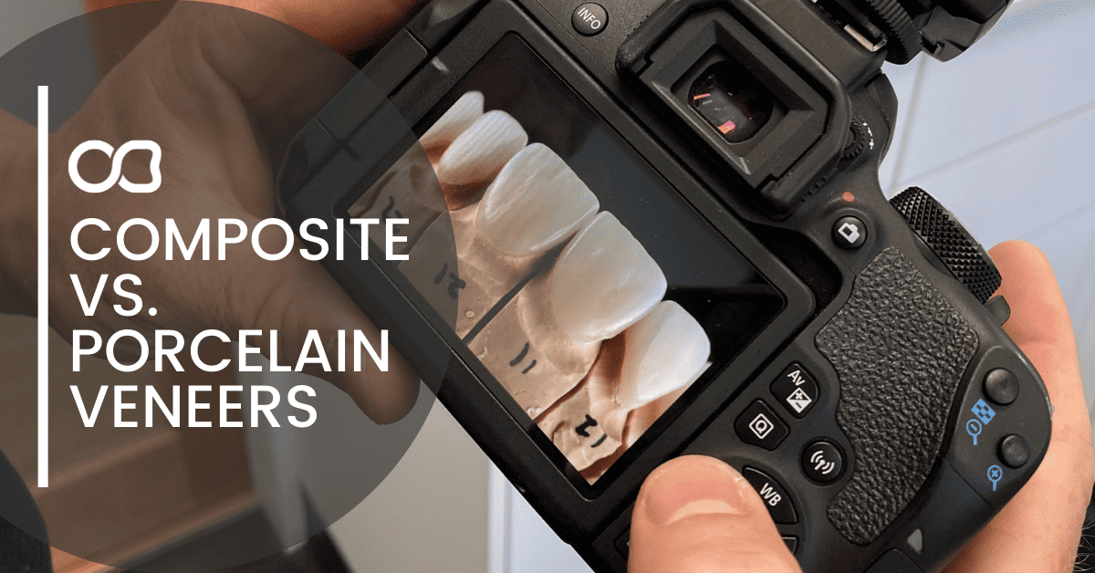 veneers-on-camera-screen-gold-coast