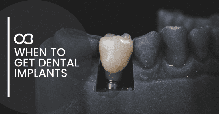 when-to-get-dental-implants-blog