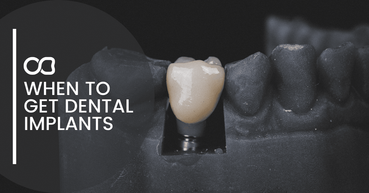 when-to-get-dental-implants-blog