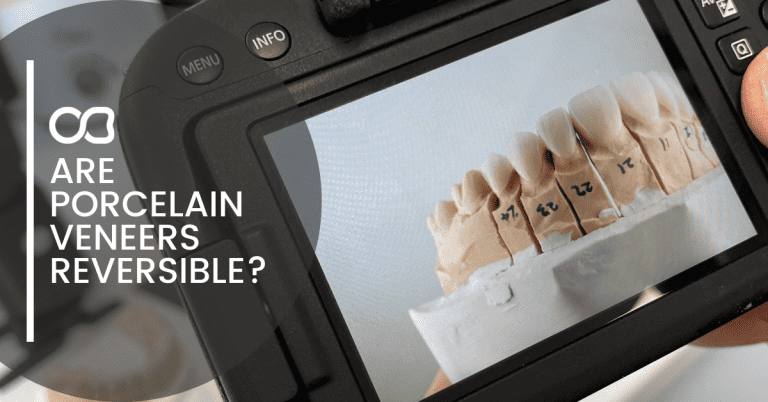 porcelain-veneers-on-camera-screen