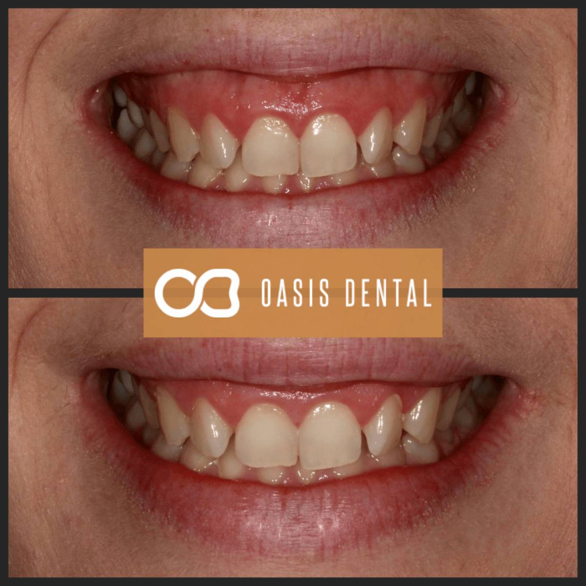 General and Cosmetic Dentistry Gold Coast Oasis Dental Studio