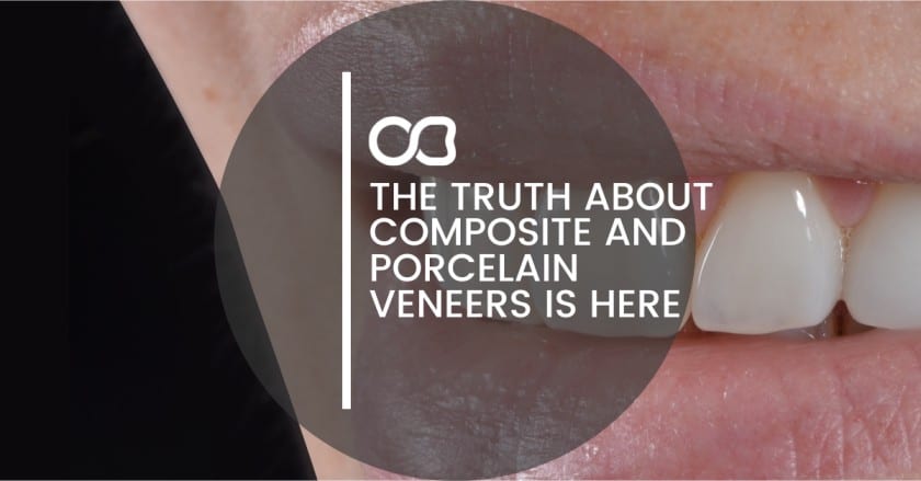 The Truth About Composite and Porcelain Veneers is Here - 10