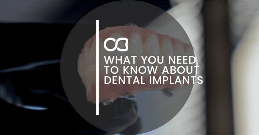 What You Need To Know About Dental Implants - 14