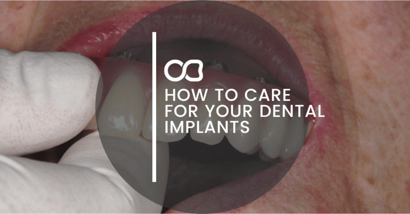 How to Care for Your Dental Implants - 8
