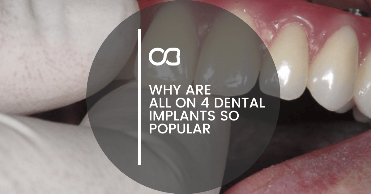 How to Take Care of Your Dental Veneers