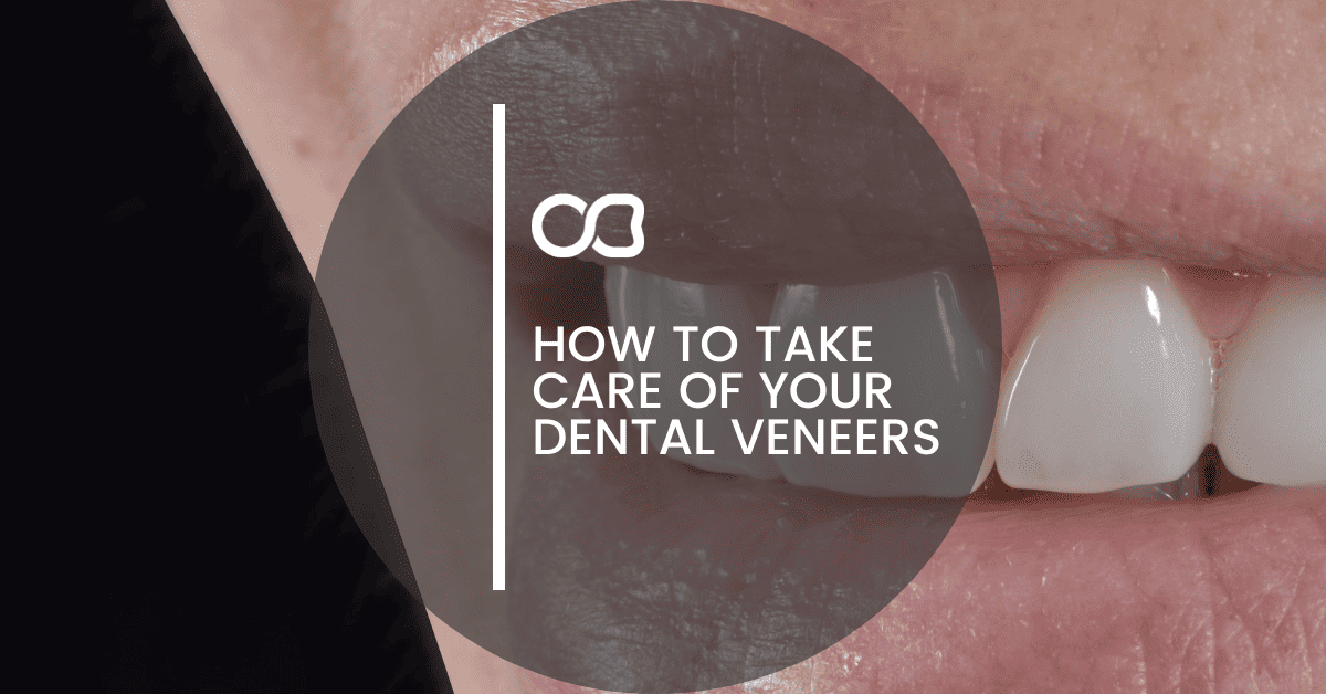 Oasis Dental Studio - How to Take Care of Your Dental Veneers - 9 How to Take Care of Your Dental Veneers