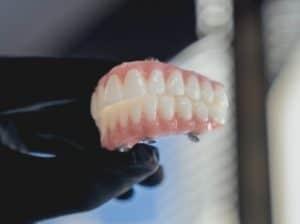 Dental implants 5, Oasis Dental Studio