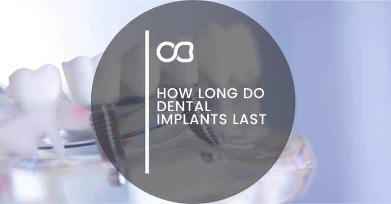 How Long Do Dental Implants Last, blog image 01