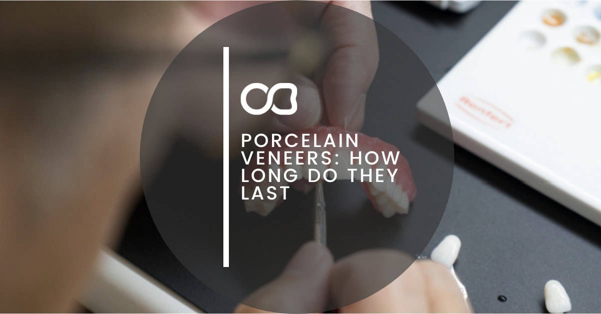 Oasis Dental Studio - Porcelain Veneers: How Long Do They Last - 4 Porcelain Veneers: How Long Do They Last, blog image 01