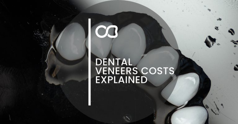 Dental veneers costs, blog 01