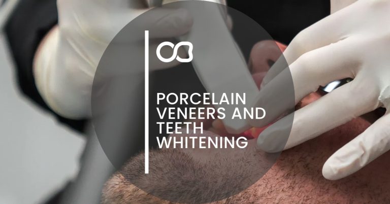 Porcelain veneers and teeth whitening, blog 01
