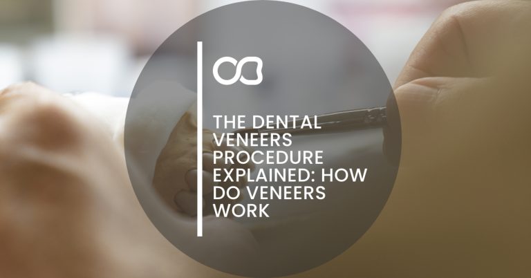 The dental veneers procedure, blog 01