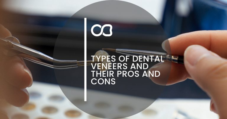 Dental veneers types, blog 01