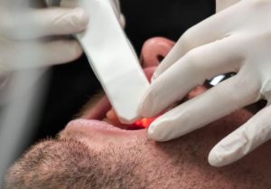 Tooth Discolouration page 2, ODS Gold Coast, Brisbane, Melbourne and Pottsville