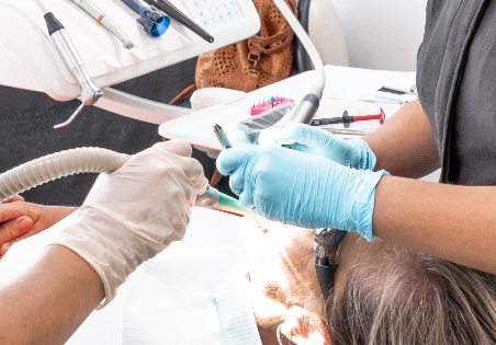 Dental conditions, tooth abscess 02, ODS