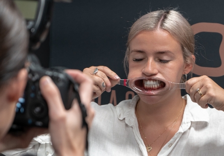 Underbite 1, ODS Godl Coast, Brisbane, Pottsville and Melbourne