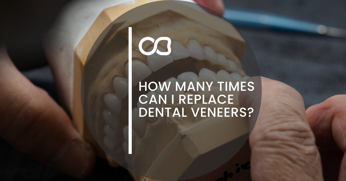 How many times can I replace dental veneers, blog 1, ODS