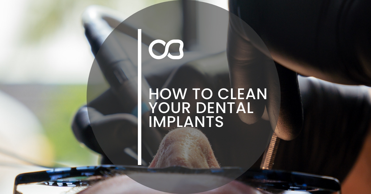 How To Clean Your Dental Implants? - 1