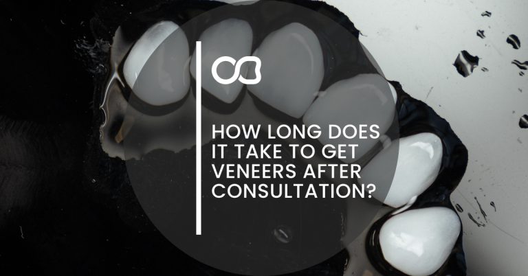 Veneers post-conusltation, blog 01
