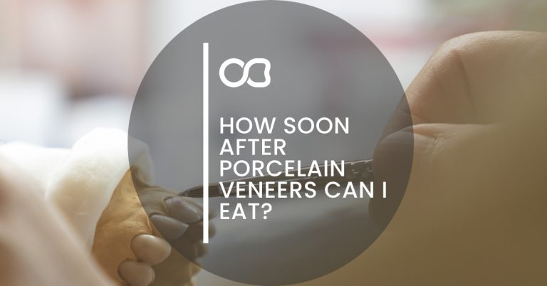 Eating after porcelain veneers, blog 01